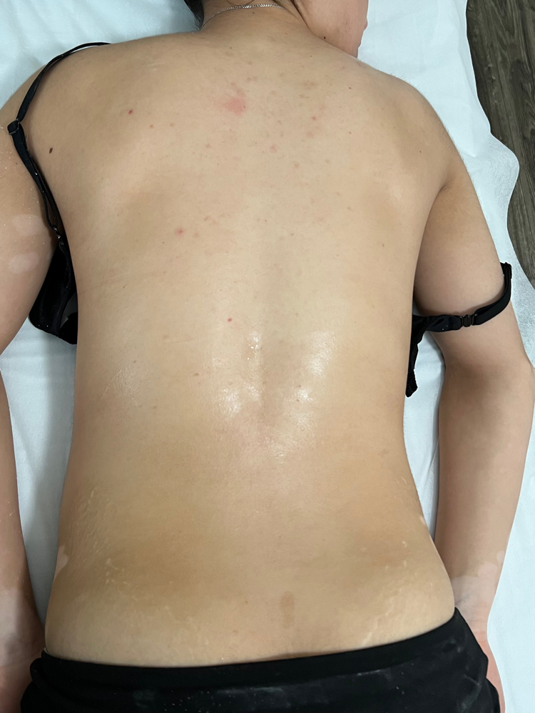 Back