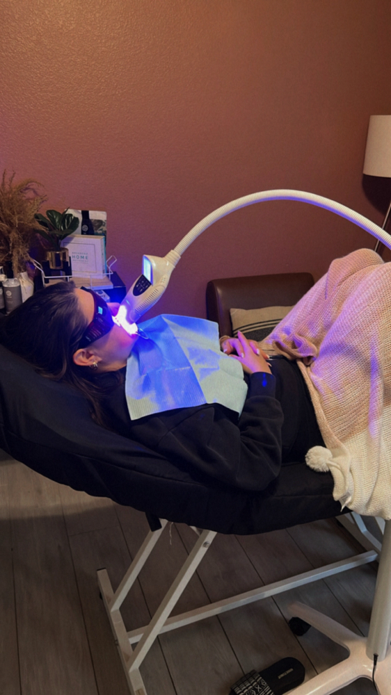 Teeth Whitening Session