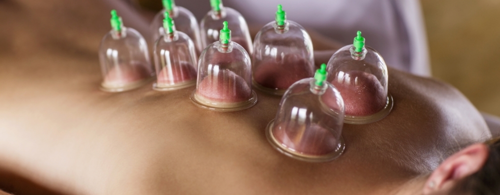 Cupping at Hands of Purpose Massage Therapy in Lorain, OH