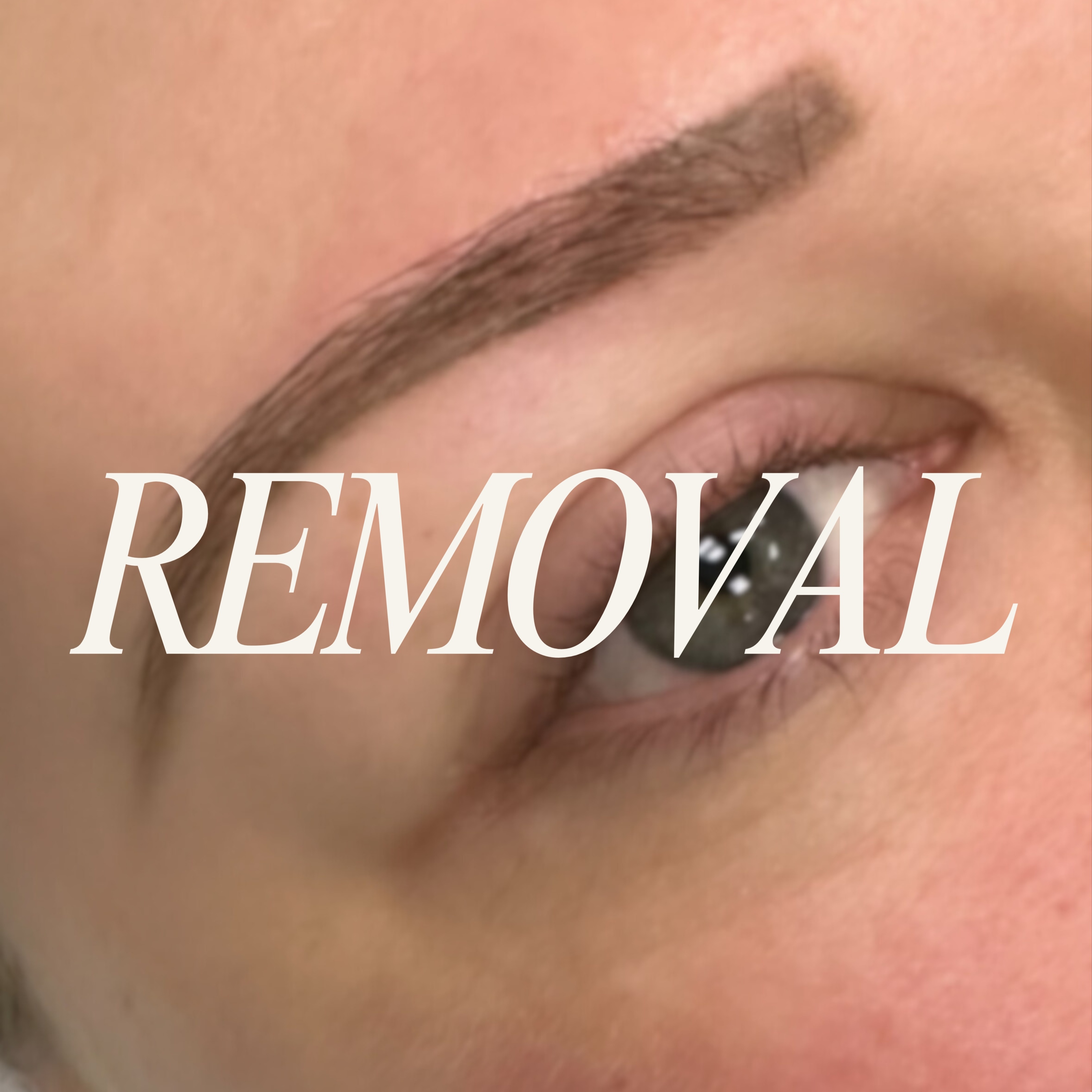 Extension Removal at kk’s secret spot in Westminster, CA