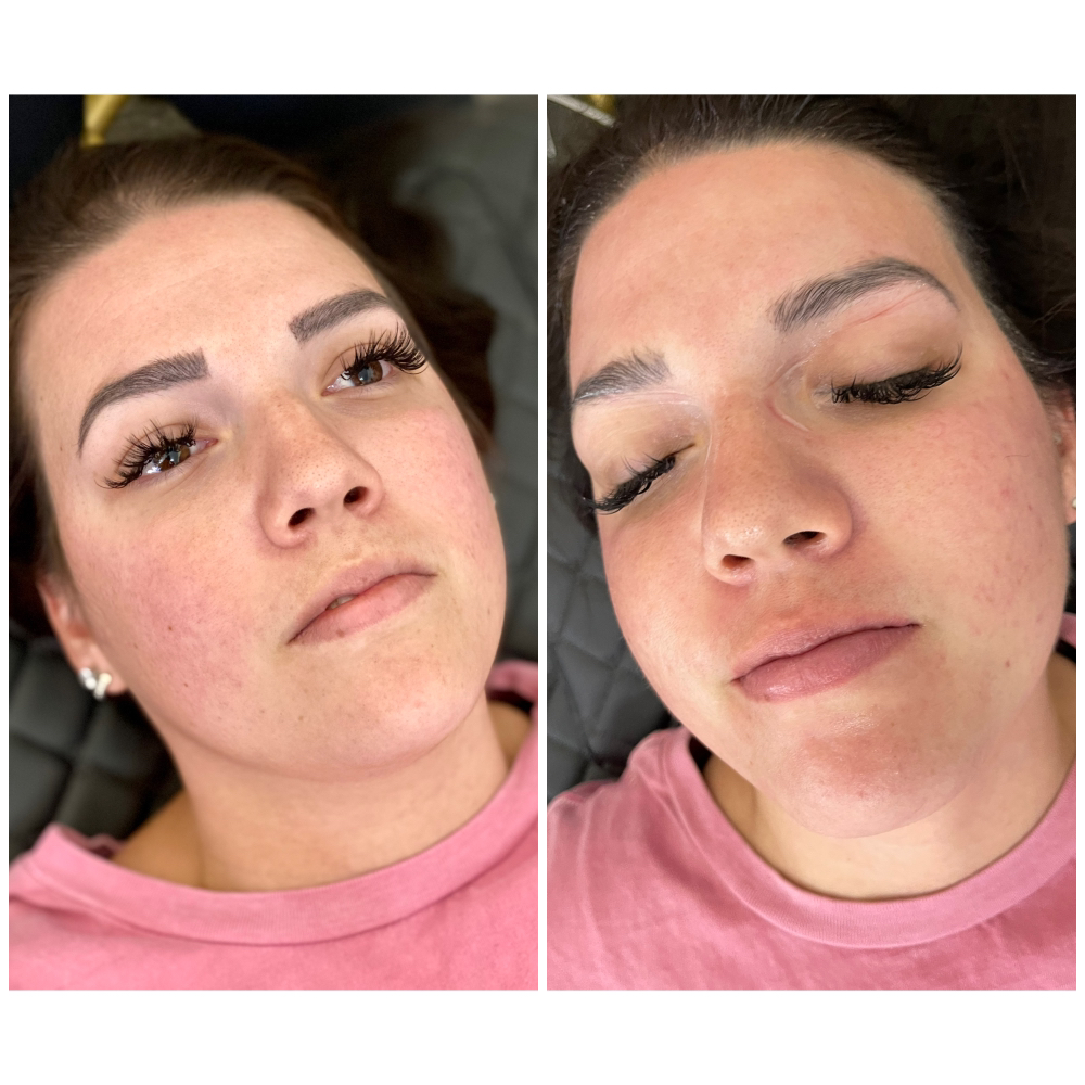 BB GLOW Facial