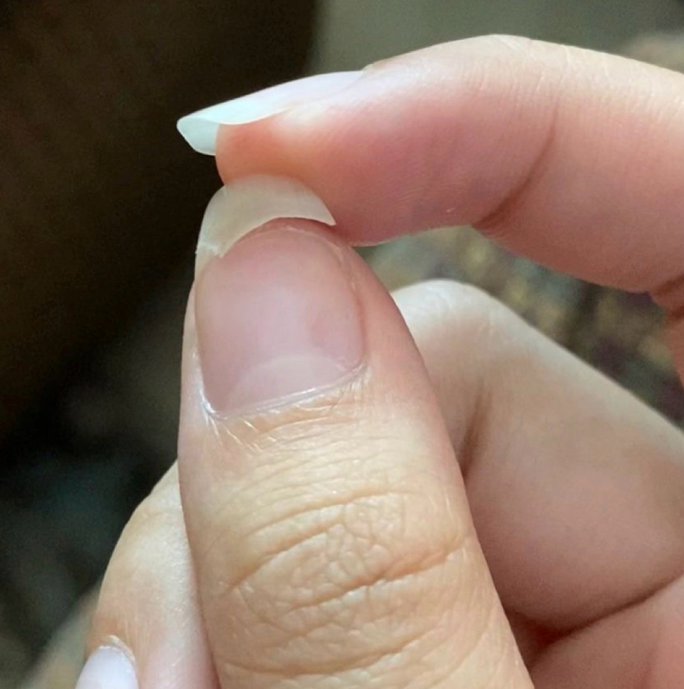 Nail Repair at Jenny Nailed It in Oakdale, CT