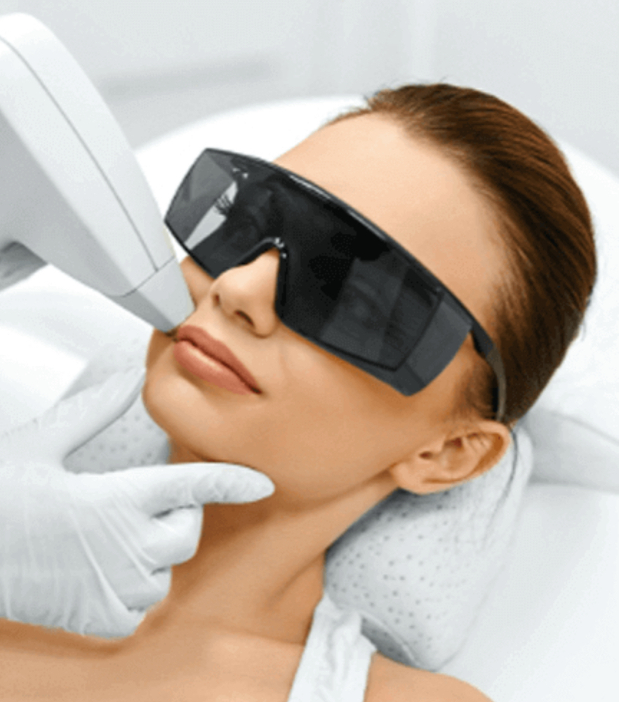 ✨Upper Lip Laser Hair Removal ✨