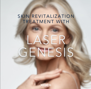 Laser Package Limelight | Laser Gen