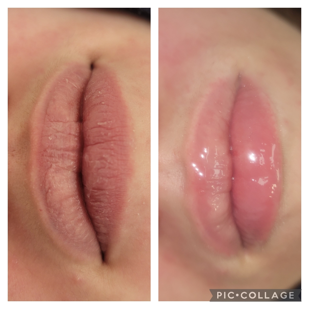 HydraGloss Lip Treatment