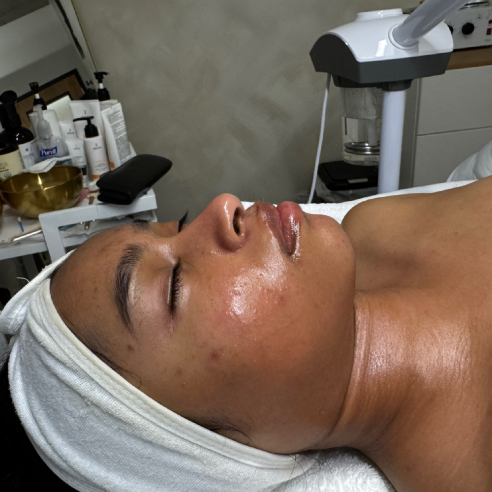 Acne Facial at VEE LUXE SPA in Seattle, WA
