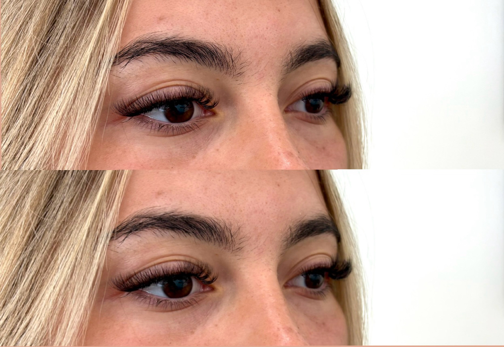 Full Set Extensions