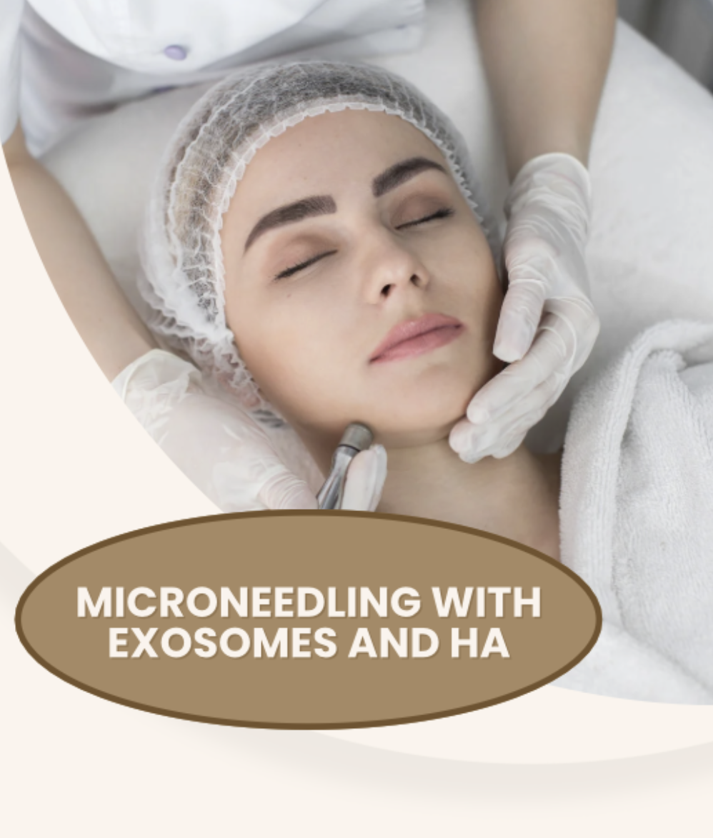 Microneedling - with HA/exosomes