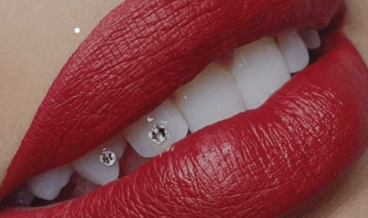 Glamour Smiles Whitening & Gems