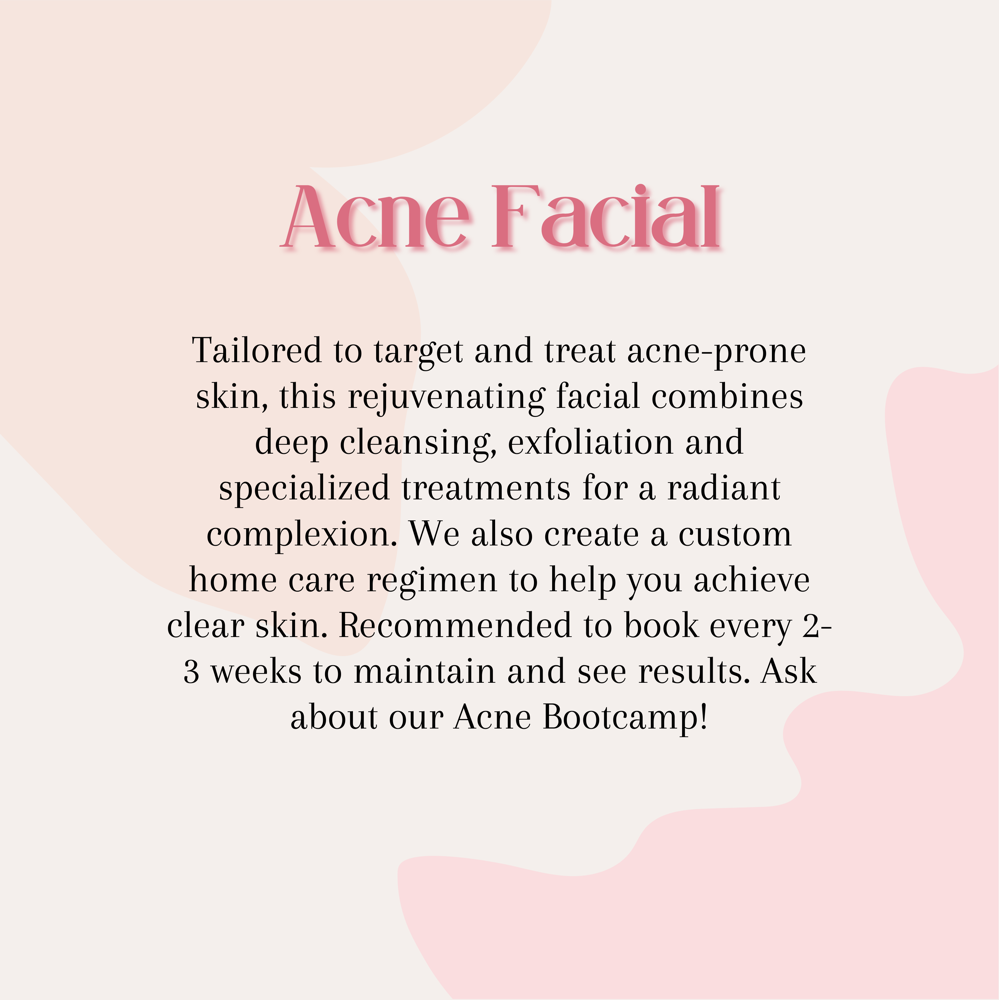 *Existing Clients* Acne Facial