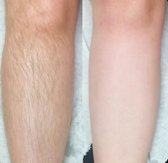 Half Legs Wax at Sunshine Beauty Salon in Corning, CA