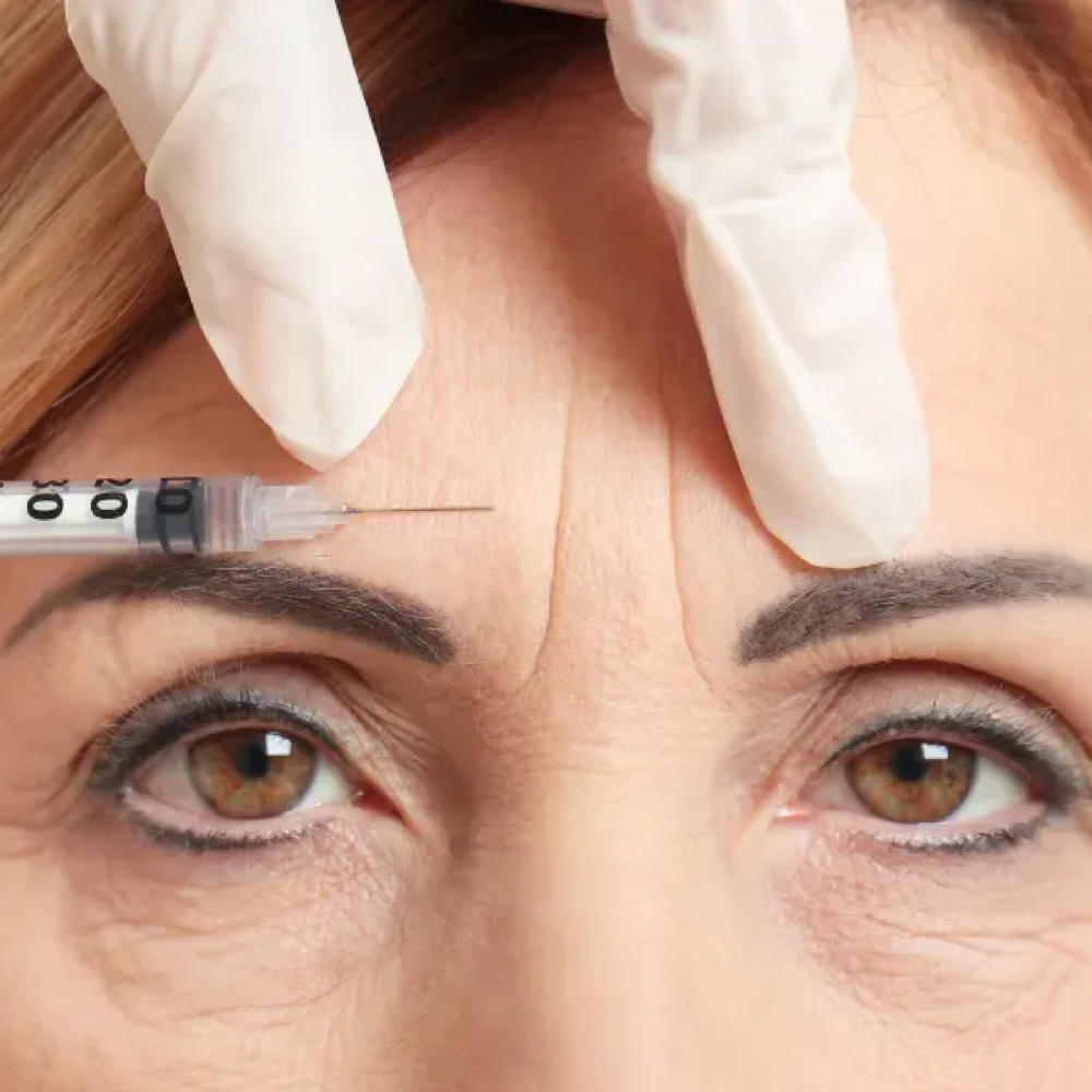 Botox Injections at Golden Glow Aesthetics in Patterson, MO