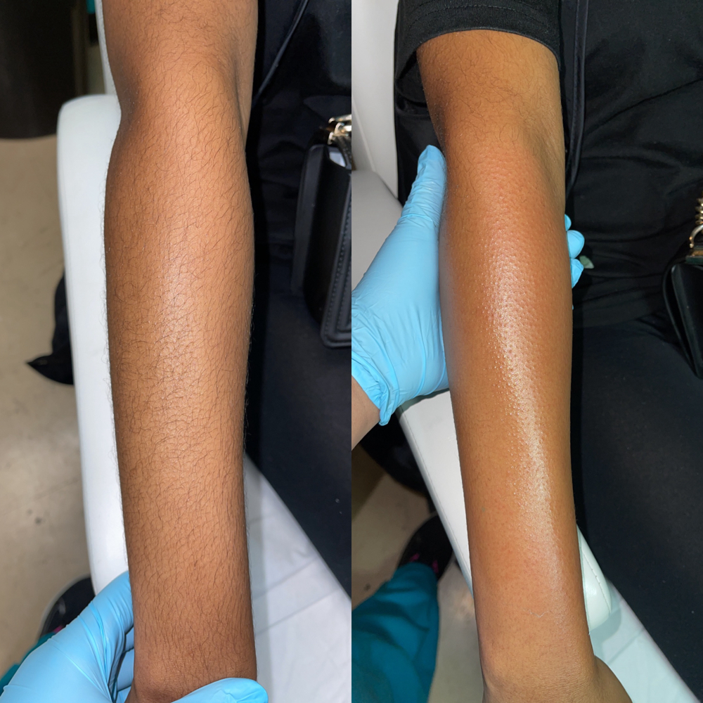 Full Arm Wax