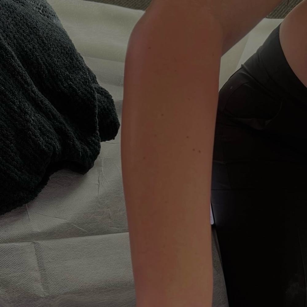 ARMS