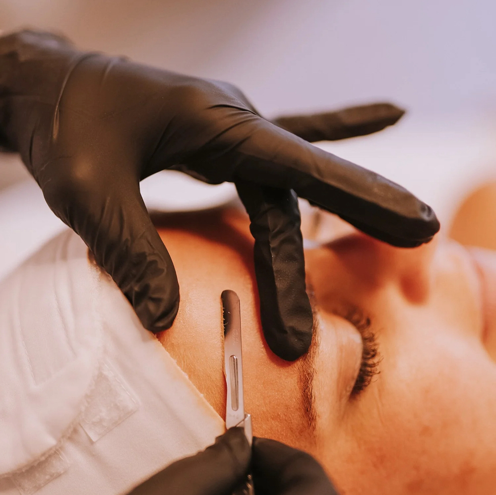 Dermaplane at Chauntelles aesthetics in Bangor, ME