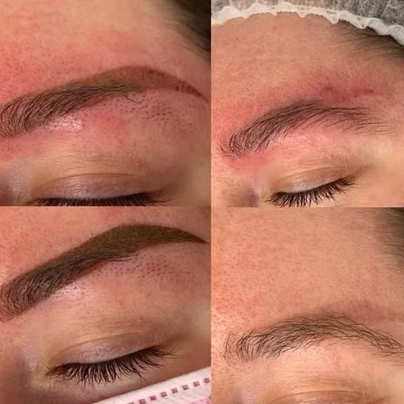 Saline Lift Removal-Brows/Lip Blush