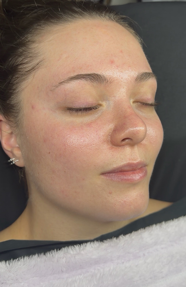 Jaime’s Signature Mini Facial at Jaime Rose Esthetics in Accord, NY