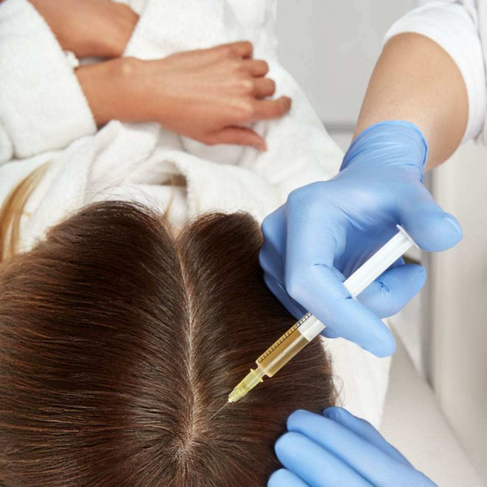 PRP/Microneedling For Hair Loss at Sharon Nicole Aesthetics in Patchogue, NY