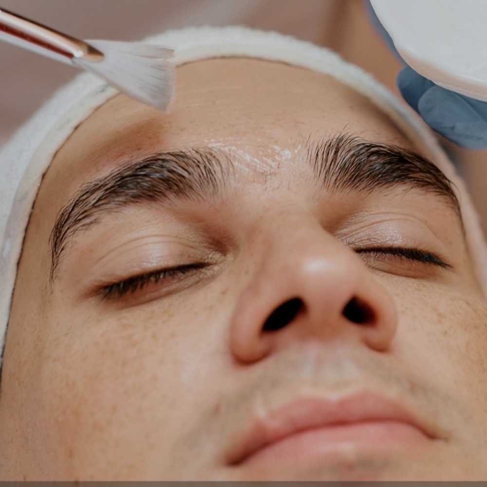 Chemical Peel at Desert Glow Esthetics in EL Paso, TX