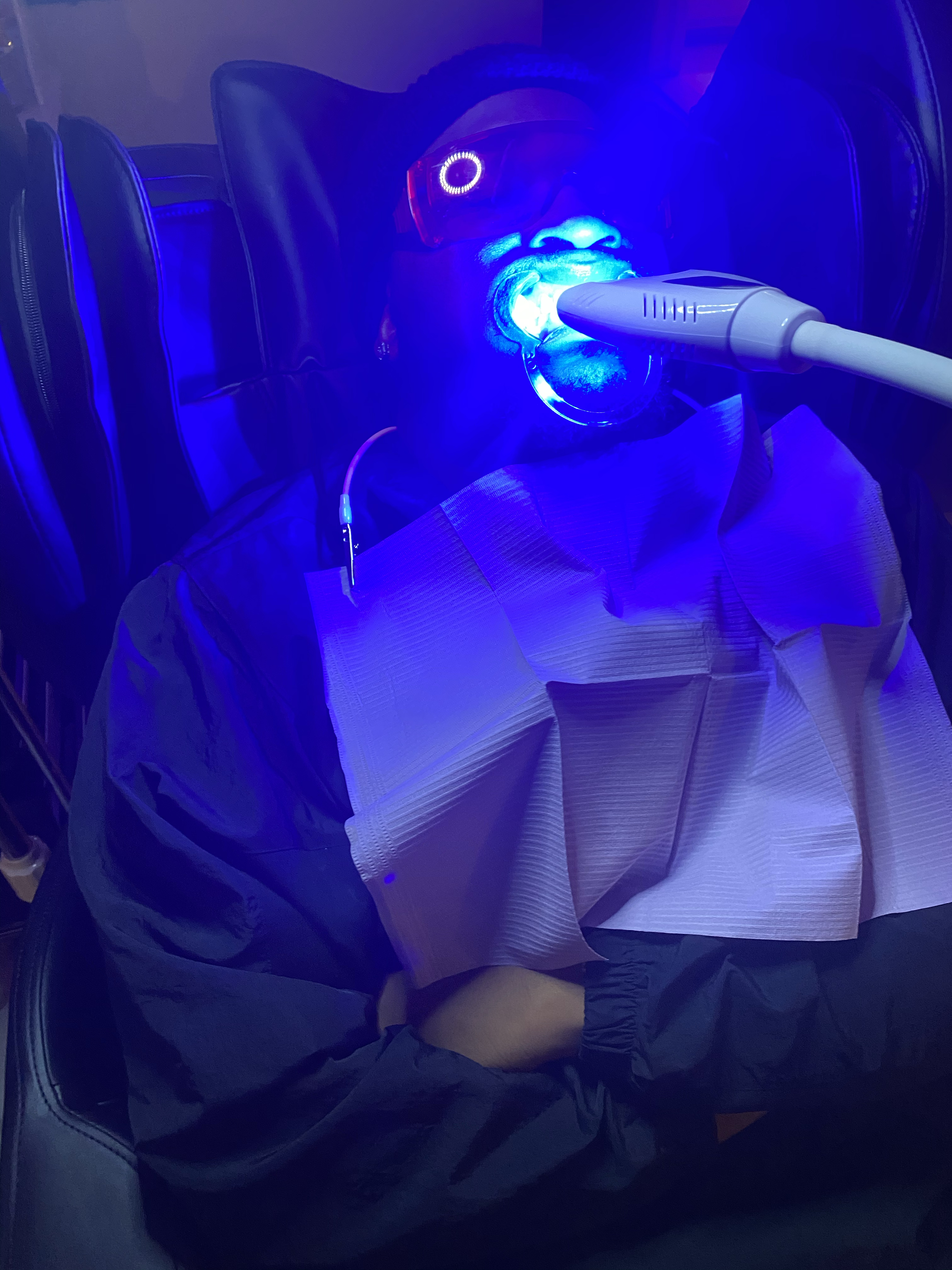 Teeth Whitening