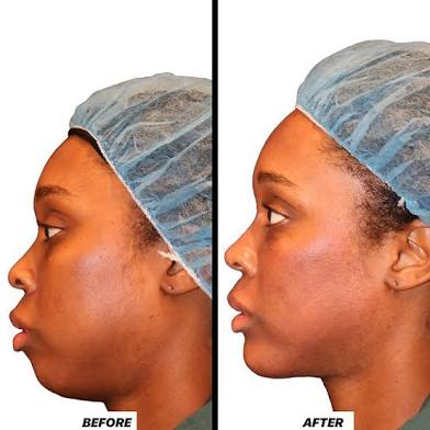 Face Sculpting