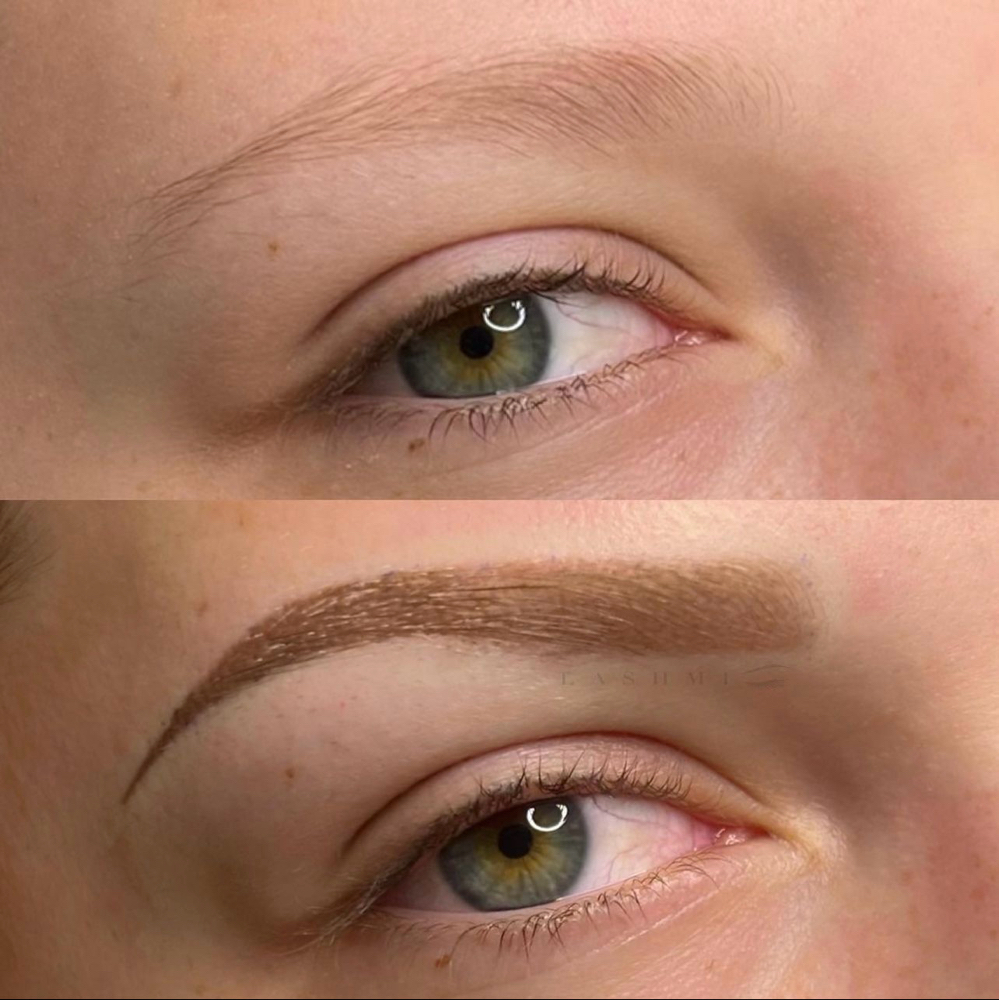 Brow Enhancement