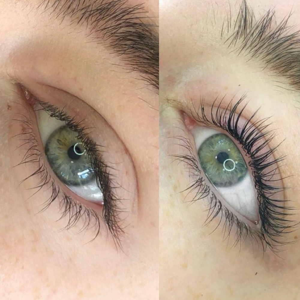 The Delicate Lift at Delicate Esthetics in Murrieta, CA
