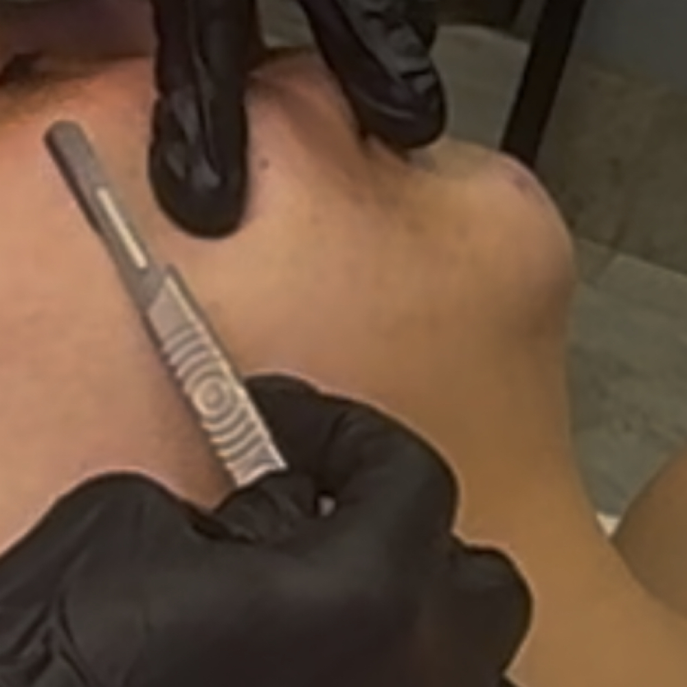 Dermaplaning at Sacred Skin Studio in Duncan, OK