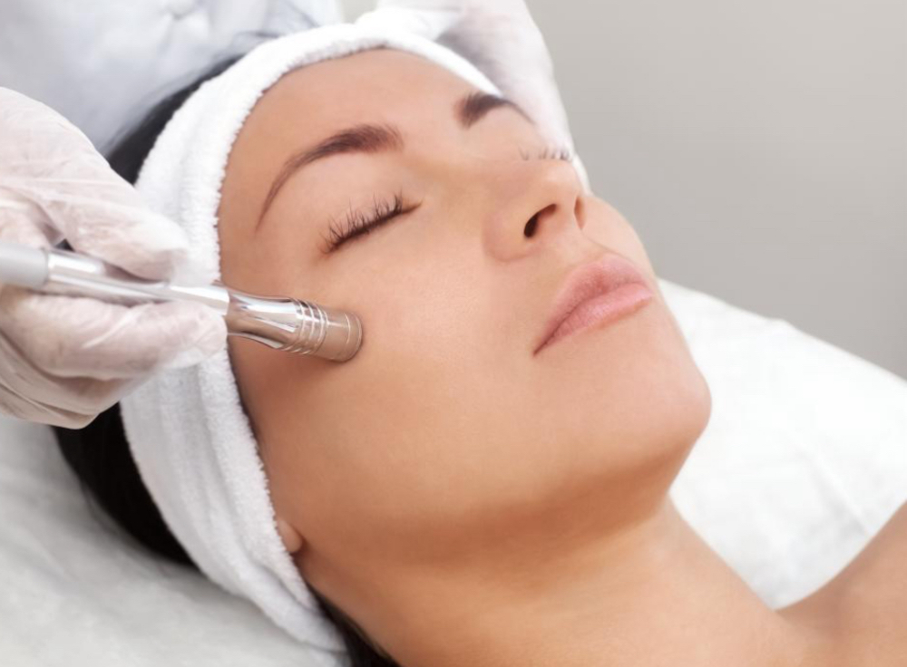 Microdermabrasion
