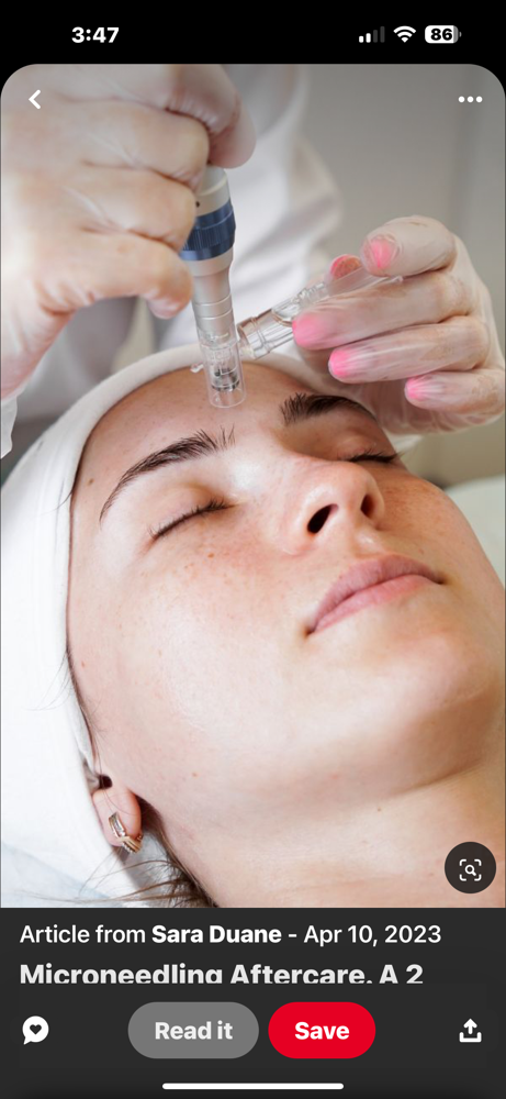 Microneedling