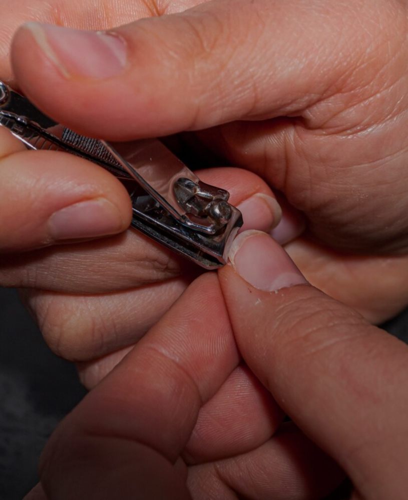 Finger Nail Trim