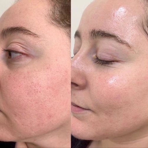 Nano Infusion Ritual at Xo Nail Salon in Watseka, IL