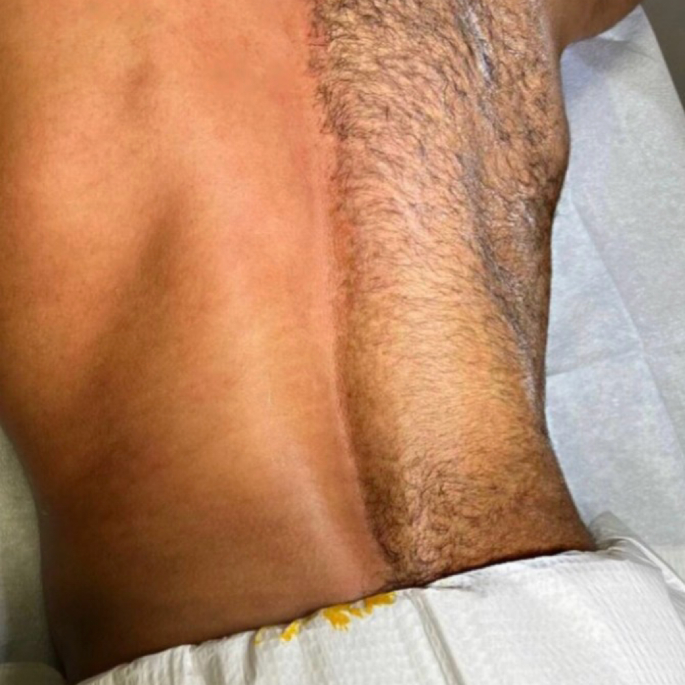 Back Waxing at Glamouré in Watervliet, MI