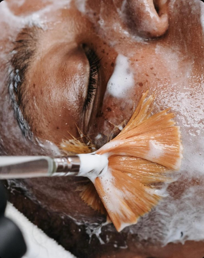 Custom Chemical Peel