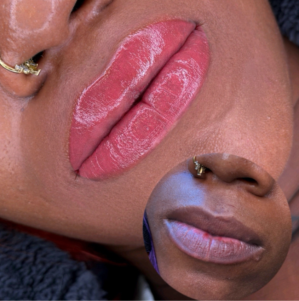 Lip Neutralization (Dark Lips) at Vogetica Beauty Lab (Regina) in Dallas, TX