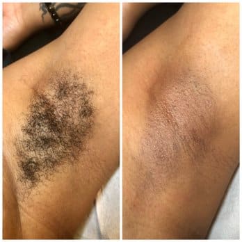 Underarm Wax
