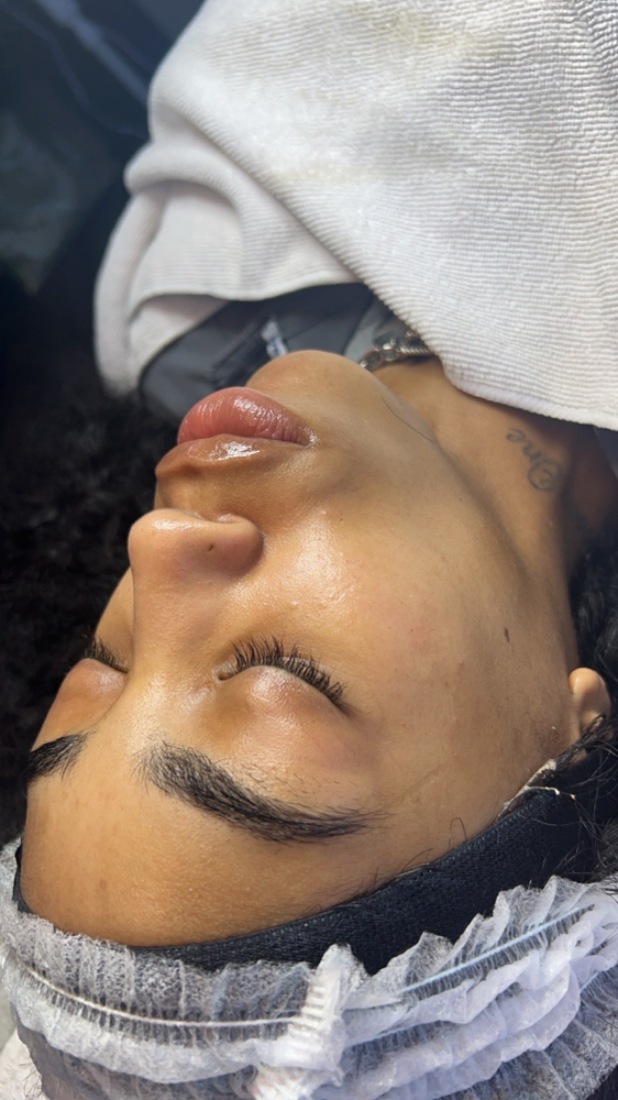 Teen Facial
