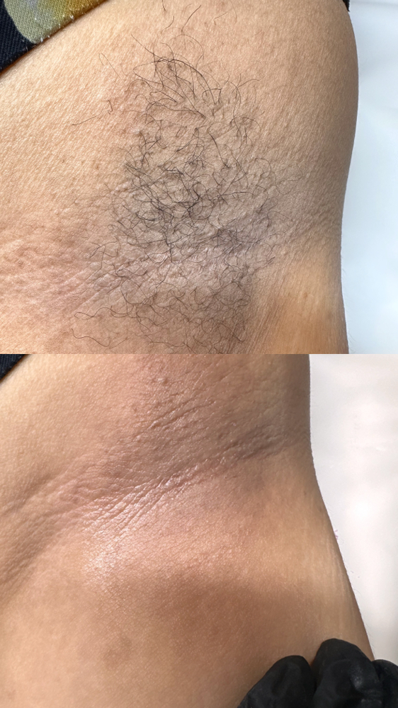 Underarm Wax
