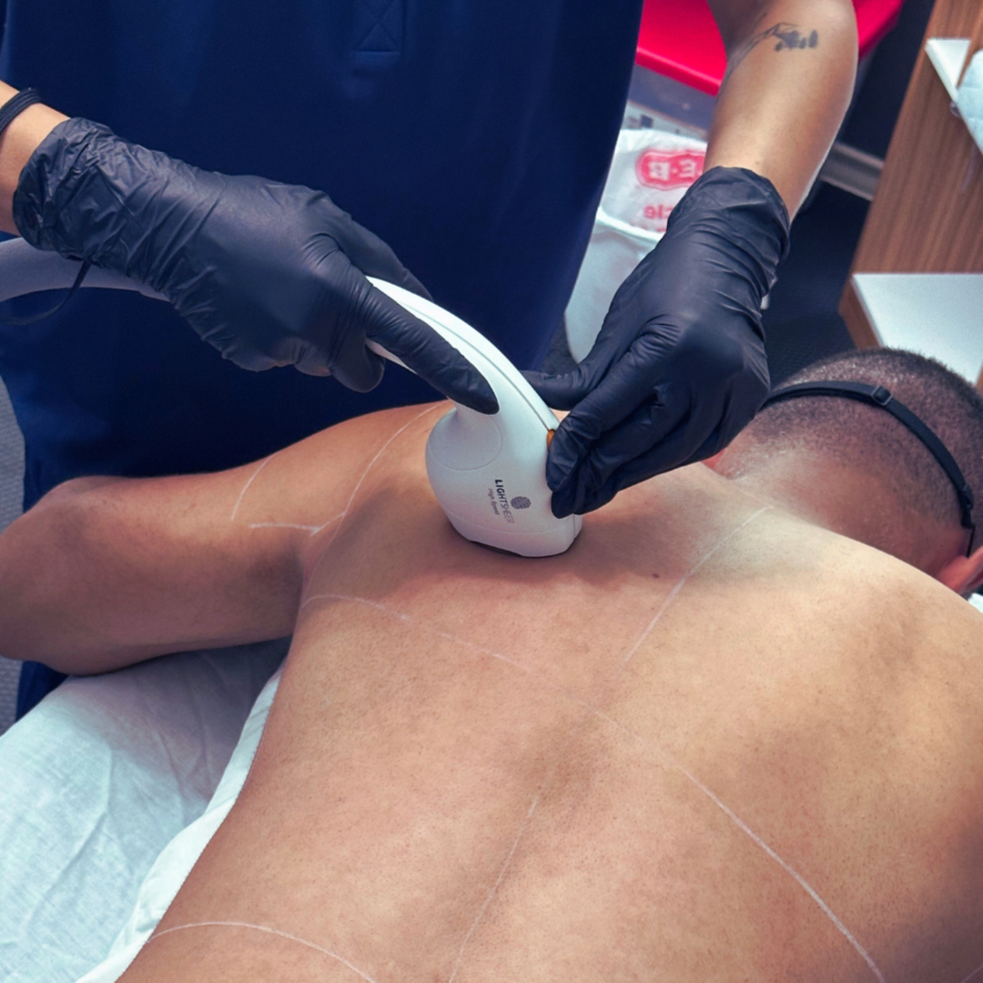 Laser Hair Reduction Large area at The Laser Collective in Gilbert, AZ