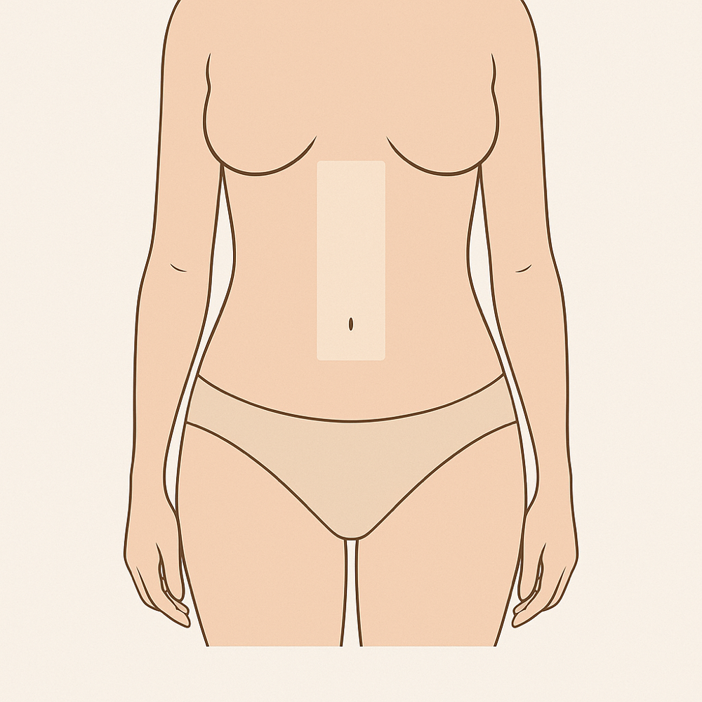 Stomach Strip at BareSkinAesthetics in Ridgeland, MS