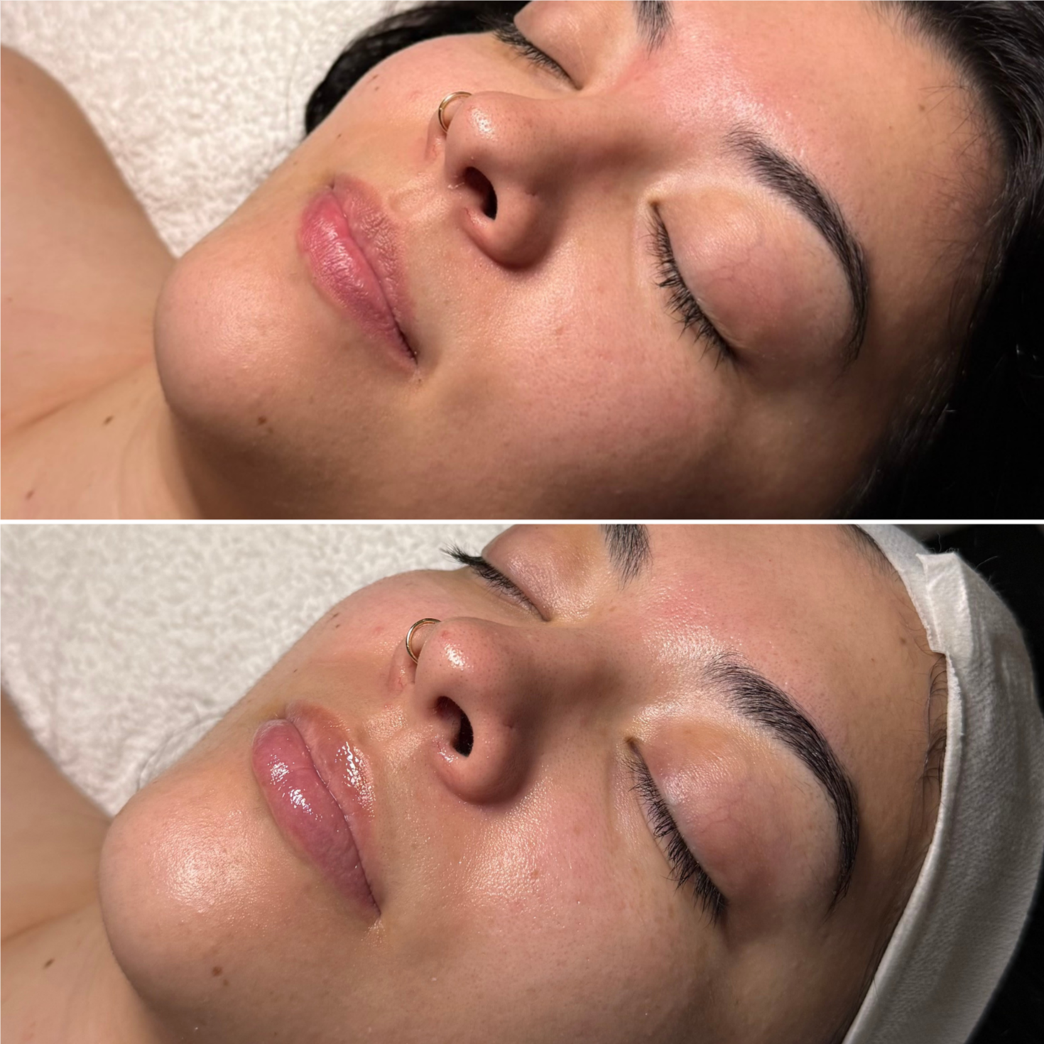 Signature Reset Initial Treatment at Luana Esthetic in Las Vegas, NV