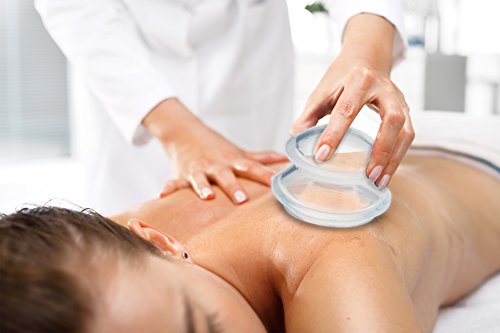 100min Cupping Massage
