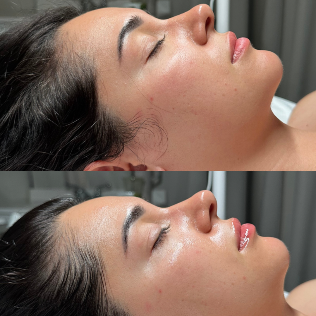 Elevate Signature Facial