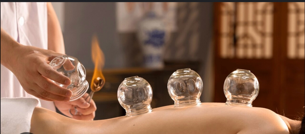 Cupping