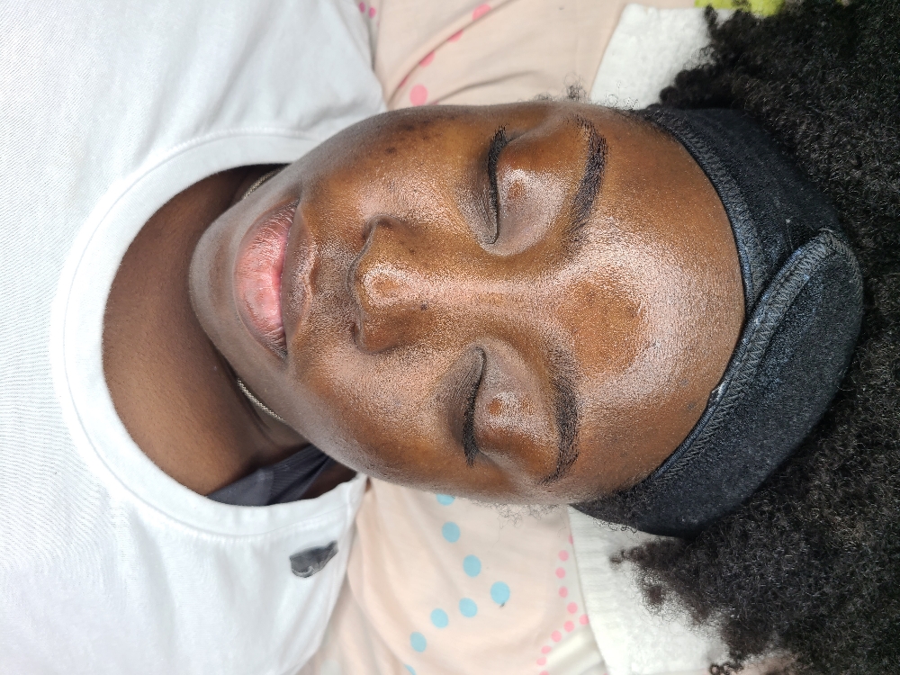 Microdermabrasion Facial
