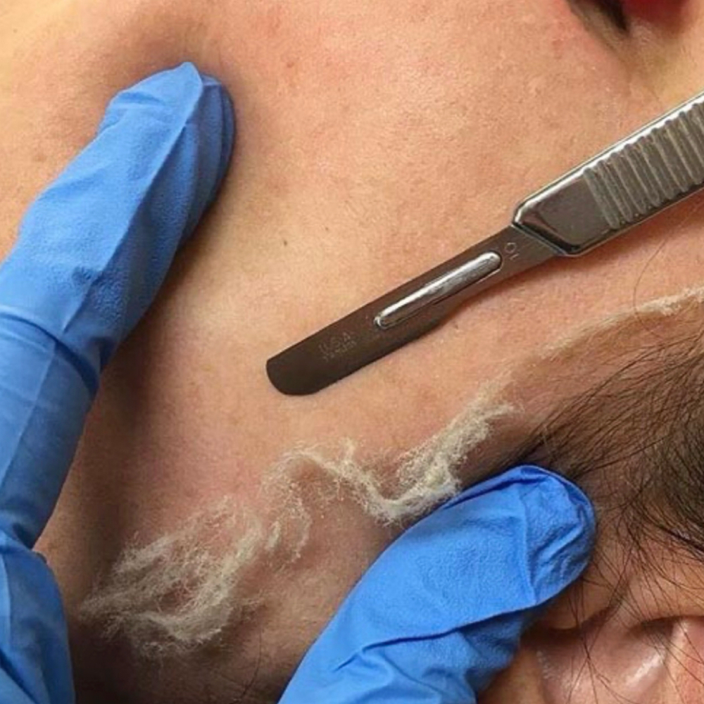 Dermaplaning Add-On at Jennifer Lauren Esthetics in Lexington, NC