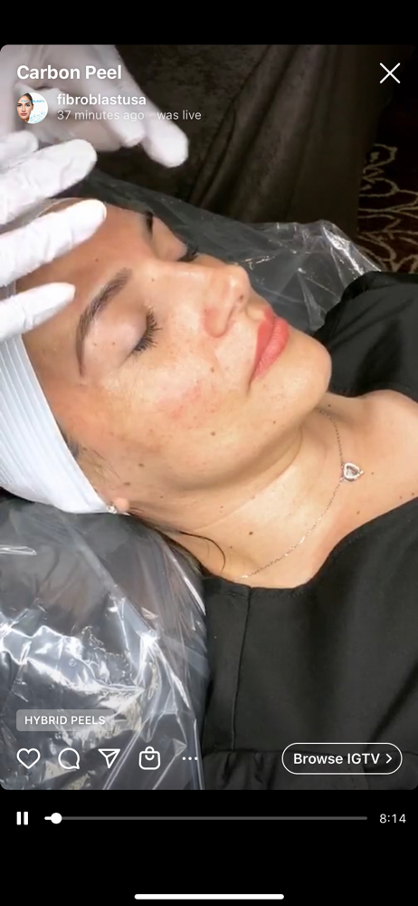 Vitamin C + Oxygen Facial