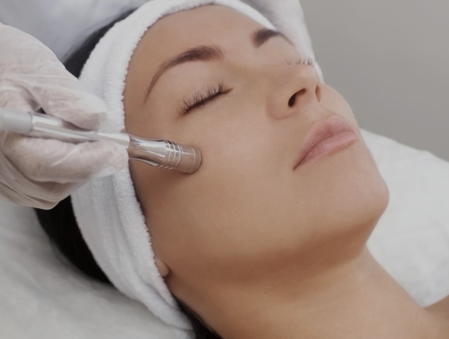 Microdermabrasion Facial