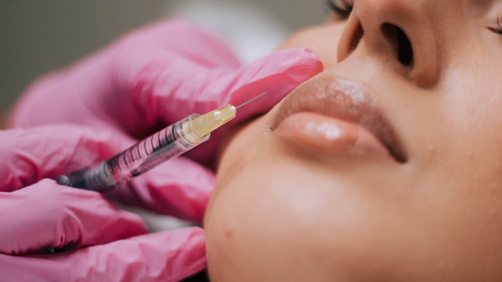 Lip Filler