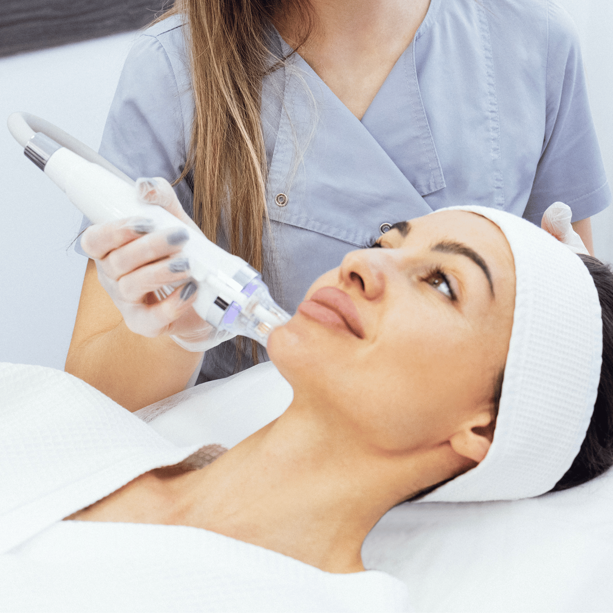 Add On RF Microneedling on Neck